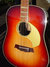 Rickenbacker 730/12 PW Build (acoustic), Amber Fireglo: Body - Front