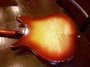 Sep 1980 Rickenbacker 320/6 VB, Fireglo: Body - Rear