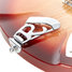 Rickenbacker 330/6 , Fireglo: Close up - Free2
