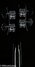 Rickenbacker 4003/4 , Jetglo: Headstock - Rear